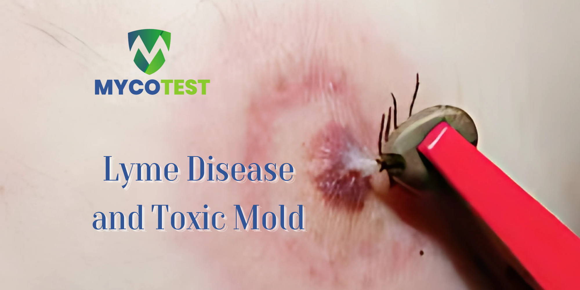 Lyme Disease and Mold: Understanding the Connection